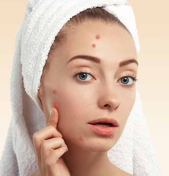 acne-reduction-facial